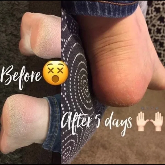 - (2) TWO Epoch NuSkin Sole Solution foot treatment
